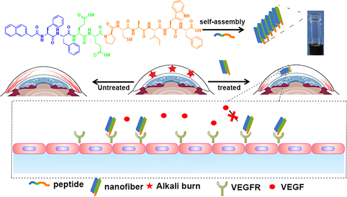 Scheme 1 Illustration of the self-assembled molecular hydrogel and nanofibers inhibiting neovascularization in a CNV model.