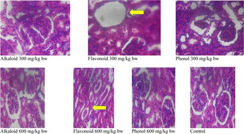 Figure 3. Histomicrogram of the kidney of alkaloid, flavonoid and phenolic extracts of S. acuta leaf in albino rats. (Arrow indicates renal vacuolation at 300 mg/kg bw which was corrected at 600 mg/kg bw).