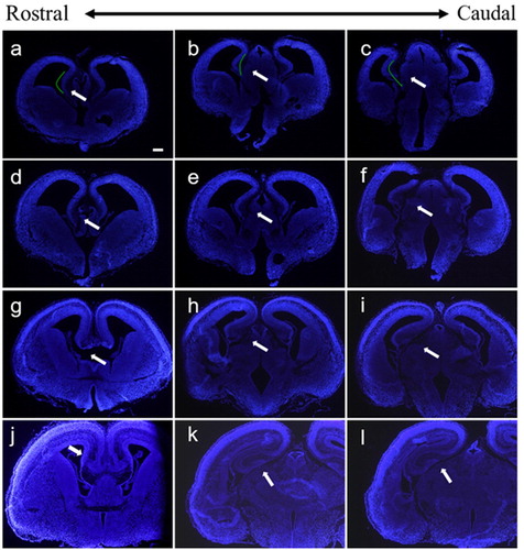 Figure 5. Coronal sections of the embryonic brain at different stages. (A–C) Hippocampus at E13.5 stage, (D–F) hippocampus at E14.5 stage, (G–I) hippocampus at E15.5 stage, and (J–L) hippocampus at E16.5 stage. The white arrows indicate the hippocampus at different stages. The scale bar was 200 μm.