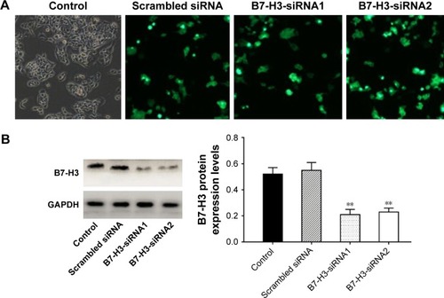 Figure 2 (A) The transfection efficiencies observed using fluorescence microscopy; (B) B7-H3 expression levels detected in A549 cell lines by Western blot.