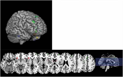 Figure 1. Differences in EF-related brain regions.