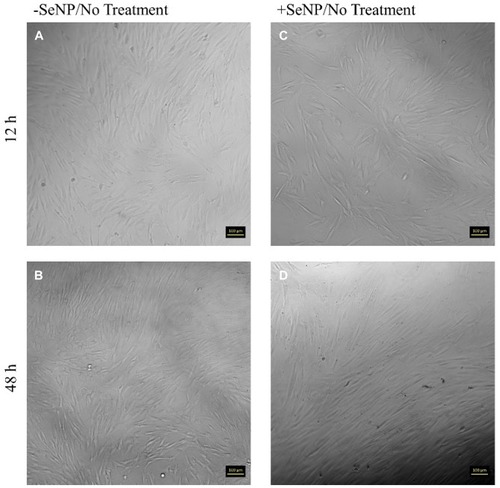 Figure 2 Phase contrast images for human dermal fibroblasts (HDFs) with a normal DMEM growth medium challenge at 12 and 48 hrs. 10× magnification. (A): –SeNP/12 hrs; (B) –SeNP/48 hrs; (C) +SeNP/12 hrs; (D) +SeNP/48 hrs. Scale bars = 100 microns.