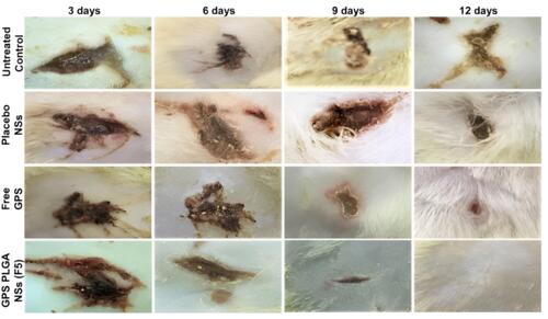 Figure 10 Macroscopic images of wound area showing healing and closure stages. The wound closure was observed at three-day intervals till day (12) post wound.