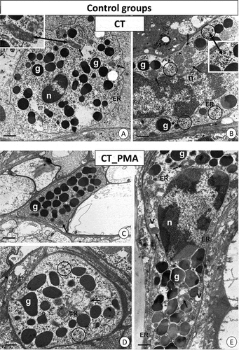 Figure 2. TEM images of granulocytes of adult specimens of Steatoda grossa from the control experimental groups: CT (a, b) and CT_PMA (c–e). Nuclei (n), granules of different electron densities (g), mitochondria (black arrows), glycogen granules (black circles), vacuoles (v), cisterns of the endoplasmic reticulum (ER). TEM. (a) Scale bar = 1.3 µm. (b) Scale bar = 1.2 µm. (c) Scale bar = 1.4 µm. (d) Scale bar = 1.2 µm. (e) Scale bar = 1.2 µm.