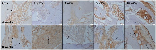Figure 8. Collagen 1 expressions (indicated by arrows) at 4 weeks (upper row) and 8 weeks (below row) groups. Streptavidin biotin peroxidase method, scale bar = 50µm.