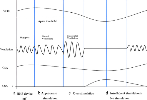 Figure 6 The possible mechanism of TECSA following HNS.