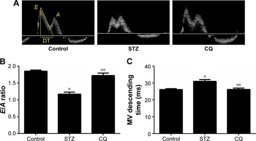 Figure 3 Effects of CQ on diastolic function of the heart in STZ-induced mice.