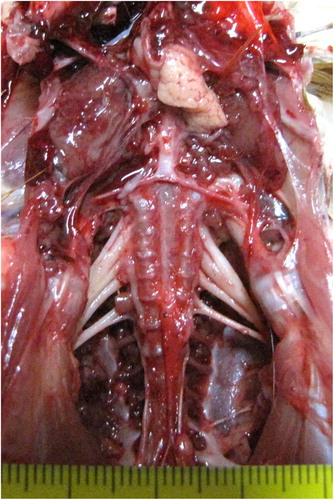 Figure 2. Bilateral enlargement of the sciatic plexus in a pullet from case 7. Nerves appear hypertrophied, oedematous, and lacking cross striation.