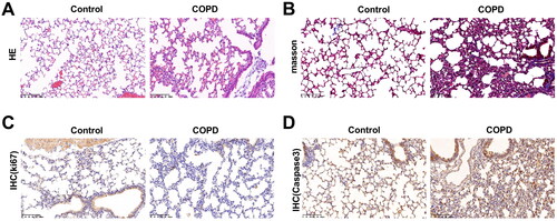 Figure 1. Successful construction of COPD mouse model. Hematoxylin-eosin staining and Masson staining of lung tissues in Control and COPD. (A) Hematoxylin-eosin staining of lung tissues in each group (200×, 100 μm). (B) Masson staining of lung tissues in each group (200×, 100 μm). (C–D) Detection of ki67 and Caspase-3 by immunohistochemistry (200×, 100 μm).