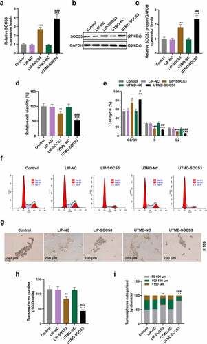 Figure 3. The comparison on the effects of liposome and UTMD transfection with SOCS3 on the viability, cell cycle and sphere formation of BCSCs. BCSCs were separately transfected with NC or SOCS3 overexpression plasmid using liposome (LIP) (1 μg plasmid + 2 μL Lipofectamine 2000) or ultrasound microbubbles (ultrasound radiation conditions: 1 MHz, 0.75 W/cm, 45 s). (a-c) RT-qPCR and Western blot were used to quantify the expression of SOCS3 in cells of each group after transfection. (d) The change of cell viability is detected at 48 h by MTT assay. (e-f) Flow cytometry was performed to detect the cell cycle. (g-i) The number and size of tumor spheres in cells of Control, LIP-NC, LIP-SOCS3, UTMD-NC, UTMD-SOCS3 groups were determined by the sphere formation assay (magnification × 100). *P < 0.05, **P < 0.01, ***P < 0.001 vs. LIP-NC; ^^^P < 0.001 vs. UTMD-NC; ##P < 0.01, ###P < 0.001 vs. LIP-SOCS3.