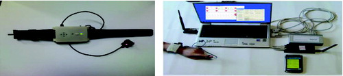 Figure 2. PPG signals obtained using pulse-measuring equipment.