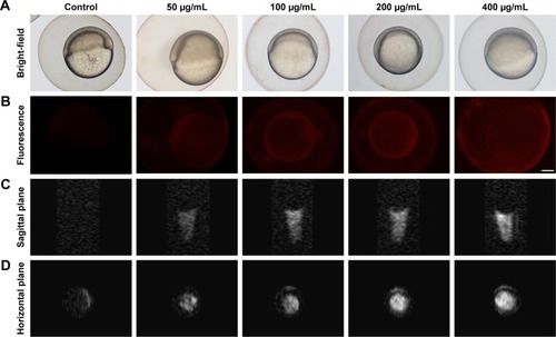 Figure 3 Fluorescence imaging and MRI of FA-NPMOFs in zebrafish embryos.Notes: (A, B) Bright-field and fluorescence images of FA-NPMOF-exposed zebrafish embryos. Note that the red fluorescence was emitted by FA-NPMOFs. (C, D) MRI scans on the (C) sagittal and (D) horizontal planes. Scale bar in (A, B): 100 µm.Abbreviations: FA-NPMOF, folic acid-nanoscale gadolinium-porphyrin metal-organic framework; MRI, magnetic resonance imaging.