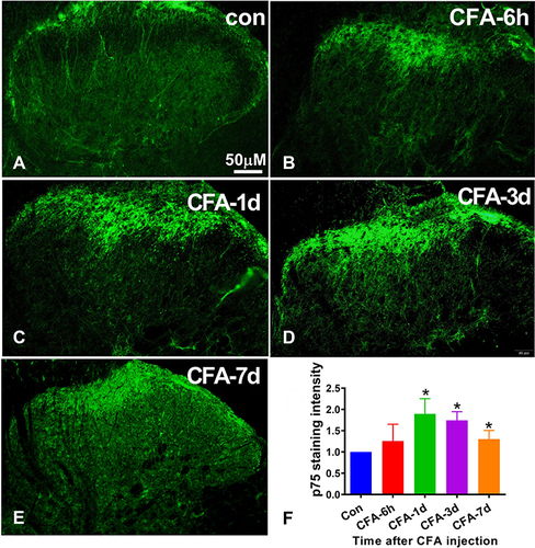 Figure 4 The expression of p75NTR in spinal cord in CFA induced inflammatory pain model. (A–E) Representative photomicrographs show the p75NTR immunoreactivity in the ipsilateral spinal cord at different time points (6 h, 1 d, 3 d, and 7 d) after CFA injection. Scale bar = 200μm. (F) Time course of p75NTR staining intensity in the ipsilateral spinal cord after CFA injection. Data are expressed as mean ± Sd. n = 5 for each time point. *P < 0.05 versus control group.