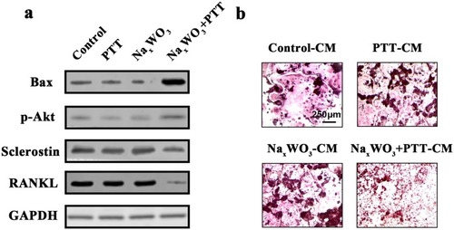 Figure 6 (A) Proteins expressions for Bax, p-Akt, Sclerostin and RANKL in 4T1 cells. (B) Osteoclastogenesis of RAW 264.7 cells at 7th day after stimulations by CM from 4T1 cells treated with control, PTT, NaxWO3, and NaxWO3+PTT. Scale bar, 250 μM.Abbreviations: PTT, photothermal therapy; CM, conditioned medium.