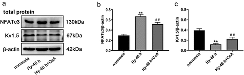 Figure 7. CsA increase the expression of Kv1.5 in PASMC after hypoxia exposure. (a) The protein trace of NFATc3 and Kv1.5 in PASMCs were detected by western blot assay. (b, c) Western blot analysis of NFATc3 and Kv1.5 in PASMCs treated with CsA. Comparisons were performed using one-way ANOVA followed by Bonferroni’s post hoc test. *P < .05, **P < .01 vs normoxia group; #P < .05, ##P < .01 vs Hy-48 h group. The results are expressed as the mean ± SEM. CsA, Cyclosporine; Kv1.5, potassium voltage-gated channel subfamily A member 5; PASMCs, pulmonary arterial smooth muscle cells; SEM, standard error of mean.