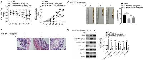 Figure 5. miR-151-5p knockdown improved UC symptoms in mice.