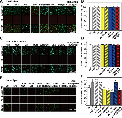 Figure 3 In vitro cytotoxicity of carrier materials (MSN and Gel) and different formulations, including BBR solution (BBR), BBR@MSN, DEX solution (DEX), DEX@Gel and BBR@MSN-DEX@Gel, and their anti-inflammatory effectiveness. (A) Representative photos and (B) relative cell viability of human conjunctival epithelial cells (HconEpics) (n = 6). (C) Representative photos and (D) relative cell viability of MIC-iCELL-m001 (n = 6). (E) Representative photos and (F) relative IL-17A concentration of LPS-stimulated HconEpics (n = 4). Cells without any manipulation were set as the control group (Ctrl, 100%). *p<0.05 vs LPS and &p<0.05 vs BBR@MSN-DEX@Gel (Two-way ANOVA).