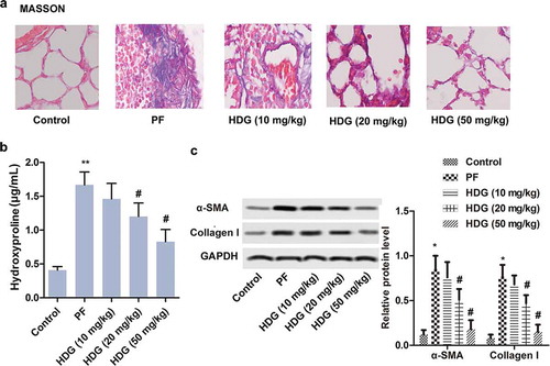 Figure 3. HDG alleviated collagen deposition induced by BLM in PF rats.Rats were randomly divided into 5 groups (n = 10): Control group, PF group, HDG (10 mg/kg) group, HDG (20 mg/kg) group and HDG (50 mg/kg) group. a. Fibrosis level was assessed by MASSON staining. b. The level of Hydroxyproline. c. The protein levels of α-SMA and Collagen I was measured by western blotting. (** p < 0.01 vs control group; # p < 0.05 vs PF group)