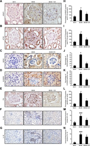 Figure 3 Changes in ARAP1, AT1R, NOX2, 8-OHdG, FN, IL-1β and IL-18 expression in the kidney tissues of 20-week-old mice were assessed by immunohistochemistry. (A-G) Immunohistochemistry for ARAP1, AT1R, NOX2, 8-OHdG, FN, IL-1β and IL-18 expression. (H-N) Semiquantitative analysis of the immunohistochemistry results. #p<0.05, ####p<0.0001 compared with db/m mice and *p<0.05, **p<0.01 compared with diabetic db/db mice.