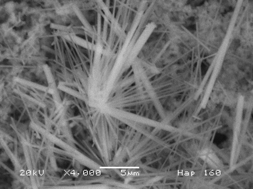 Figure 3. SEM micrograph of sample prepared at pH = 9. Hap needles 12 µm long are observed, some as thick as 1 µm are present. Some form bundles from a common origin.