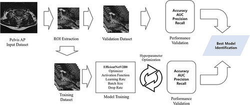 Figure 1 Diagram of the process for the development of the deep learning model for predicting the therapeutic outcome after transforaminal epidural steroid injection in patients with cervical foraminal stenosis.