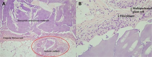 Figure 2 Microscopic examinations.