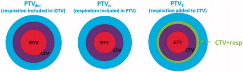 Figure 2. Illustration of three different PTVs generated.