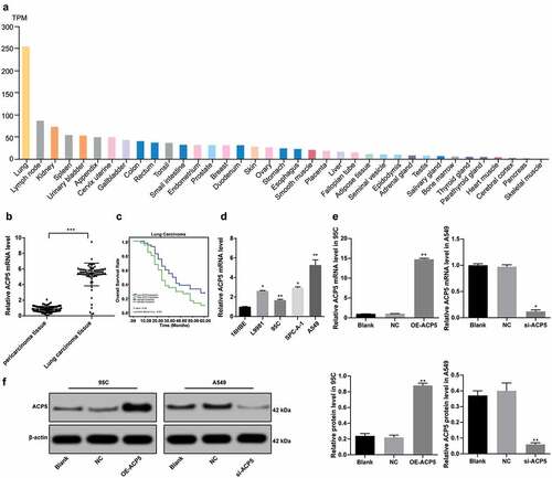 Figure 1. ACP5 is highly expressed in LC tissues and cells. a. Relative ACP5 expression in different cancer tissues; b. Relative ACP5 expression in LC tissues and paracancerous tissues, *** p < 0.001, compared with paracancerous tissues; c. Kaplan-Meier survival analysis of LC patients with high or low ACP5 expression; d. Relative ACP5 expression in LC cells and tracheal epithelial cells, * p < 0.05, ** p < 0.01, compared with 16HBE cells; e. Relative ACP5 mRNA expression in 95C and A549 cells after different transfection, * p < 0.05, ** p < 0.01, compared with the NC group; f. Relative ACP5 protein level in 95C and A549 cells after different transfection, * p < 0.05, ** p < 0.01, compared with the NC group. LC, lung cancer; ACP5, tartrate-resistant acid phosphatase 5; NC, negative control