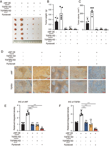 Figure 6 HSCs enhance tumor growth through JAK1/vWF/TGFB1 axis in vivo. Cells with different treatment were injected subcutaneously into nude mice and solid tumors were collected for the further analysis. (A) Tumor images; (B and C) Tumor weight and volume; (D) IHC staining results of vWF and TGFB1 in different groups; (E and F) IHC score results of vWF and TGFB1 in different groups.