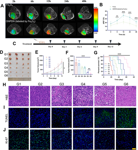 Figure 3 In vivo drug accumulation and antitumor effect analysis of ONPDN. (A) Representative R2* mapping images of nude mice bearing MDA-MB-231 mammary tumor in situ treated with Fe3O4 or ONPDN (labeled by Fe3O4) at different time points. (B) Relative percent change in R2* values of tumor area after treatment with Fe3O4 or ONPDN (labeled by Fe3O4). (C) Schematic of the treatment plan for MDA-MB-231 xenograft breast orthotopic tumor grafts. (D) Photographs of tumors obtained after 15 days from nude mice treated with PBS (G1), PDN (G2), olaparib and novobiocin (G3), NPDN (G4), OPDN (G5) or ONPDN (G6). (E) Tumor growth curves of nude mice treated with PBS (G1), PDN (G2), olaparib and novobiocin (G3), NPDN (G4), OPDN (G5) or ONPDN (G6). (F) Tumor weight at the end of treatment. (G) Tumor survival curves of nude mice treated with PBS (G1), PDN (G2), olaparib and novobiocin (G3), NPDN (G4), OPDN (G5) or ONPDN (G6). (H) H&E staining of nude mice in different groups treated with PBS (G1), PDN (G2), olaparib and novobiocin (G3), NPDN (G4), OPDN (G5) or ONPDN (G6). Scale bar = 100 μm. (I) TUNEL staining of nude mice in different groups treated with PBS (G1), PDN (G2), olaparib and novobiocin (G3), NPDN (G4), OPDN (G5) or ONPDN (G6). Scale bar = 100 μm. (J) Ki67 staining of nude mice in different groups treated with PBS (G1), PDN (G2), olaparib and novobiocin (G3), NPDN (G4), OPDN (G5) or ONPDN (G6). Scale bar = 100 μm. All data are shown as mean ± SD (n = 4). *P < 0.05; **P < 0.01; ***P < 0.001.