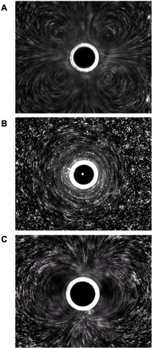 Figure 6 Different microstreaming fluid flow patterns around microbubbles oscillating in diameter under the influence of ultrasound. The microbubbles are the dark circles with white outlines in the center of each frame. The little white dots are particles that mark the streamlines of fluid flow patterns in the surrounding water. The microbubbles are all roughly the same size in each frame, and the different flow patterns shown in frames (A–C) arise from different driving ultrasound frequencies. Reprinted from Collis J, Manasseh R, Liovic P, et al. Cavitation microstreaming and stress fields created by microbubbles. Ultrasonics. 2010;50(2):273–279. Copyright 2010, with permission from Elsevier.Citation70