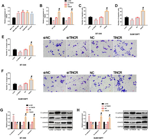 Figure 2 Regulatory effects of TINCR on the metastatic potential of TNBC cells. (A) The results of RT-PCR showed that TINCR was generally up-regulated in TNBC cells, and its expression level was higher in BT-549 and SUM159PT cells. (B) The results of RT-PCR showed that transfection of TINCR and si-TINCR could up-regulate and down-regulate TINCR, respectively. (C and D) Transwell showed that TINCR could regulate the migration level of BT-549 and SUM159PT cells. (E and F) Transwell showed that TINCR could regulate the invasion level of BT-549 and SUM159PT cells. (G and H) Western blot analysis showed that up-regulation of TINCR significantly promoted EMT, while down-regulation of TINCR significantly inhibited EMT, as well as its protein profiling.