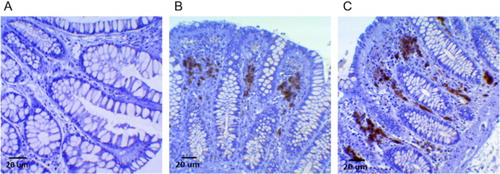 Figure 3. Immunohistochemical staining of MPO-positive cells in healthy human colonic mucosa samples. In (A) the colonic mucosa does not show a significant presence of MPO-positive cells, whereas in (B) a low/moderate expression is evident as dark-brown staining between crypts, particularly at the luminal pole. In (C), MPO-positive cells are well-recognizable as dark-brown staining also more deeply in the stroma at the base of the crypts, where epithelial stem-cell niches are present. Additional Figures (A to J) are available online.