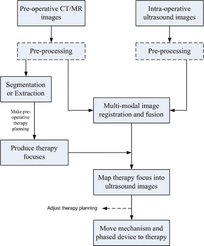 Figure 2. Flowchart of the image-guided localization system in our HIFU.