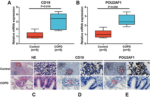 Figure 7 Expression of CD19 and POU2AF1 by qRT-PCR and immunohistochemistry. (A) The mRNA levels of CD19 in human lung tissues. (B) The mRNA levels of CD19 in human lung tissues. The mRNA levels of CD19 and POU2AF1 were normalized to β-actin. **P<0.01 compared with the control group. (C) HE staining in control and patients with COPD. (D) Immunohistochemical staining for CD19 in control and patients with COPD. (E) Immunohistochemical staining for POU2AF1 in control and patients with COPD. Positive protein staining appeared brown and nuclear staining appeared blue. Scale bar =100 μm, original magnification: ×50; scale bar=10 μm, original magnification: ×400.