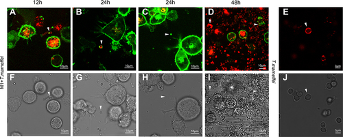 Figure 2 Live-cell imaging of co-culture of T. marneffei with CD86-EGFP-THP-1 cells by confocal microscopy. CD86-EGFP appeared with green fluorescence predominantly distributed on the cell membrane of THP-1 cells. Some of the conidia bound CD86-EGFP on the surface of the organisms. (A) T. marneffei conidia were labeled with cell membrane DIL-dye, which appeared with red fluorescence at 12 h. (B) At 24 hours, CD86-EGFP appeared as green dot-shaped particles stuck to the surface of the conidia. (C) At 24 hours, the conidia binding CD86-EGFP appeared with a body-like inclusion. (D) The conidia bind CD86-EGFP proteins, as indicated by the arrow in the top right corner. The proliferation of T. marneffei to be discovered, followed by the appearance of the fission yeasts (the arrow in the top left corner showed) at 48 h. Meanwhile, a decrease in the activity of macrophages was observed, with fluorescence intensity decreasing significantly. (E) T. marneffei conidia were cultured without macrophages. No green fluorescence was observed. (F) The image of A observed under a bright field. (G) The image of B observed under a bright field. (H) The image of C observed under a bright field. (I) The image of D observed under a bright field. (J) An image of E taken in a bright light. The white arrow showed T. marneffei conidia as the same as appeared in images of (A–E), respectively (original magnification: (A, C, D, I, F, H) ×630; (B, E, G, J) ×1000).