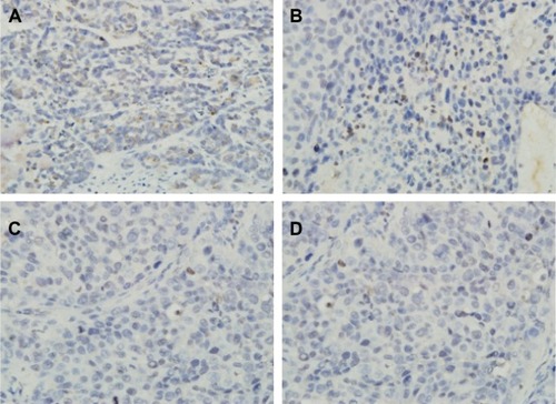 Figure 9 Immunohistochemical staining for Bax.Notes: Representative immunohistochemical staining with Bax polyclonal antibodies in each group. Apoptosis cells are identified by dark brown (original magnification, ×400). It is evident that the abundance of apoptosis tumor cells is higher in the combined therapy group (A) and the thermotherapy-alone group (B) than in the gene transfection-alone group (C) or blank control (D).Abbreviation: Bax, Bcl-2 associated X protein.