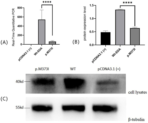 Figure 2 (A) Real-Time Quantitative PCR:Compared with wild-type EDA, the mutant EDA protein significantly inhibited the expression of EDA level.****means p <0 .0001 (Student t test). (B and C) Protein expression of mutant EDA1 in transfected cell.HEK293T cells were transfected with vectors encoding mutant or wild-type soluble FLAG-tagged EDA1 protein, cell lysates were separately analyzed by western blotting, β-tubulin was used as a loading control. The bands showed that wild-type EDA1 can produce proteins, the weaker bands of p.M373I mutations in the cell lysates showed decreased intracellular protein expression. ****means p <0 .0001 (Student t test).