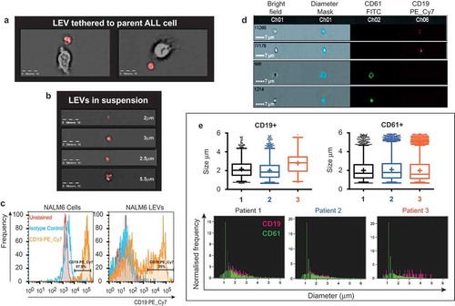 Figure 1. LEVs are detected by imaging flow cytometry and distinguishable from platelets in clinical samples. (a) LEVs tethered to the parent SD1 cell were observed using imaging flow cytometry. SD1 cells cultured in serum-free RPMI for 24 h were incubated with an AEP activity binding-probe which fluoresces red on cleavage by active AEP a lysosomal cysteine protease. Fluorescence and brightfield images were acquired enabling visualisation of red fluorescence from cleaved ABP (emission 555 nm) localised to the extracellular vesicle. Scale bar is 10 µm. (b) LEVs of varying sizes (2–5.5 µm) were also observed in suspension in healthy SD1 cultures (>97% viability). Cells were probed with an AEP activity-binding probe as before. (c) NALM6 LEVs express the BCP marker CD19. CD19 expression was detected by imaging flow cytometry (Amnis Imagestream) in cells (left panel) and a proportion of LEVs (right panel) released into serum free RPMI over 24 h. FCS files were used to compare expression levels in the two populations using FlowJo. Plots showed more uniform LEV CD19+ mean fluorescence intensity (yellow) in the parent cells (97.9%) compared with LEVs (35%). Unstained (red) and isotype control (blue) are also shown. (d) Imaging flow cytometry distinguished NALM6 LEVs from platelets. LEVs were spiked into normal human plasma. CD61 was used to distinguish platelets from CD19 positive LEVs. Examples of the brightfield images captured at × 60 magnification with an extended depth of field, diameter mask applied for quantification and FITC and PE_Cy7 channels are shown. Scale bar represents 7 µm. A compensation matrix for dual labelling was created from these data for subsequent experiments. (e) CD19+ LEVs are present in bone marrow plasma from three BCP-ALL patients at diagnosis. Imaging flow cytometry identified CD19 PE_Cy7 (magenta) and CD61 FITC (green) positive vesicles in dual labelled bone marrow plasma samples. Dual labelling enabled distinction between LEVs and platelets in clinical samples. (Upper panel) Box-plot representation of size of vesicles detected. Box for each category represents the interquartile range of values with whiskers at 1 and 99 percentiles. Horizontal line and plus symbol denote median and mean respectively; outlier values are represented by stacked dots. Although a similar size range was detected, LEV (CD19+) size distribution was more heterogeneous compared with that of EVs which were present in the same sample and positive for the platelet marker CD61 (upper panel). (Lower panel) Histograms show the normalised frequency of diameter (µm) for comparison.