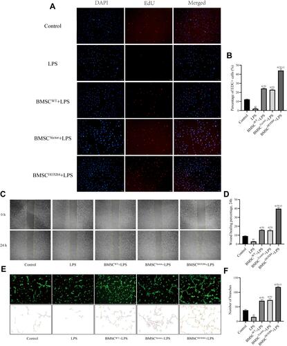 Figure 2 BMSCHOXB4 coculture promotes the proliferation, migration, and tube formation ability of ECs. (A) EdU was measured for EC proliferative capacity, of which the blue color indicated the nuclear localization and the red color indicated the proliferation-active cells (magnification 100×). (B) Quantitative analysis was conducted by calculating the percentage of proliferation-active cells, and the results suggested that BMSCHOXB4 coculture dramatically promoted EC proliferation capacity after LPS-induced injury compared to BMSCWT and BMSCVector coculture groups. (C) The scratch assay was conducted to assess the migration capability of EC, and representative images of the scratches at different time points at 0 h and 24 h are shown (magnification 40×). (D) Quantitative analysis of the changes in the scratched areas was performed using Image J software, and results suggested that the migration ability of ECs was significantly increased in the BMSCHOXB4 coculture group compared to BMSCWT and BMSCVector coculture groups. (E) Tube formation assay was performed to detect EC angiogenic capacity, and Calcein AM fluorescent dye was used to enhance the visibility of tube and network formation in Matrigel (magnification 100×), along with the trajectories of tubes and networks were also depicted accordingly. (F) Quantitative analysis suggested that coculture with BMSCHOXB4 significantly promoted the EC tube formation ability compared to that in BMSCWT and BMSCVector coculture groups. Data were expressed as mean±SD (n=3). a)Compared to control group, P <0.01; b)compared to LPS group, P <0.01; c)compared to BMSCWT+LPS group, P <0.01.