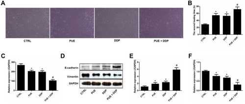 Figure 3 Migration of A549/DDP cells inhibited by various treatments and investigation of the underlying molecular mechanism. (A) Wound healing images after scratch incubation with drug-free medium (Control group), PUE (120 μg/mL), DDP (40 μg/mL), and PUE and DDP (120 μg/mL+40 μg/mL). (B) Quantitative analysis of the inhibition effect of various formulations on the migration of A549/DDP cells. (C) Determination of the levels of VEGF in A549/DDP cells after different treatment strategies by ELISA assay. (D) Qualitative evaluation of the levels of E-cadherin and Vimentin in A549/DDP cells after different treatment strategies by Western blot experiments. (E) Quantitative analysis of the expression of E-cadherin post various treatments. (F) Quantitative analysis of the expression of Vimentin post various treatments. *p < 0.05, compared with controls. #p < 0.05 compared with the cells only treated by DDP.