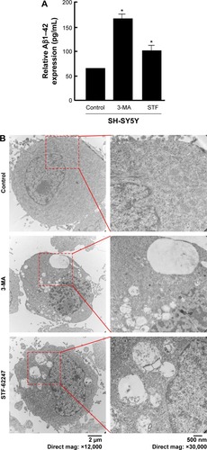 Figure 1 Modulation of autophagy affects Aβ secretion.