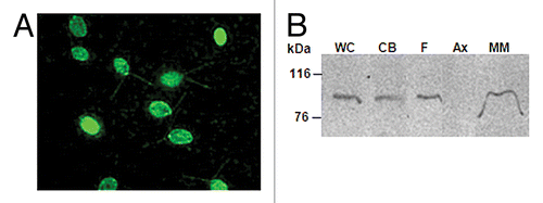 Figure 4. C. reinhardtii CDPK1 is localized in the cell body and flagella. (A) Immunostaining of cells expressing CDPK1-GFP with anti-GFP antibody. CDPK1-GFP fusion protein was localized in C. reinhardtii flagella and cell body. (B) Whole cell (WC), cell body (CB), isolated flagella (F), axoneme (Ax), and membrane-matrix (M-M) fractions of CDPK1-GFP clone were analyzed by immunoblotting using anti-GFP antibody. CDPK1- GFP fusion protein was present in the cell body and the membrane-matrix fraction of the flagella. The bar on (A) indicate 10 µm.