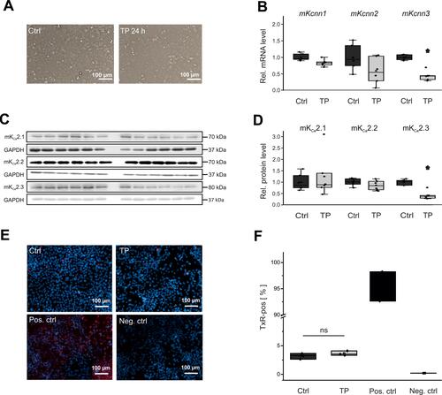 Figure 3 Effects of electrical tachypacing on KCa2 channel expression and viability in HL-1 atrial cells. (A) Representative microscopic images under control conditions (Ctrl) and after 24 h tachypacing (TP), respectively (scale bar, 100 µm). (B) Kcnn1 (n = 6), Kcnn2 (n = 6), and Kcnn3 mRNA expression (n = 6) calculated relative to untreated controls (n = 6 each). (C, D) Remodeling of KCa2.1 (n = 6), KCa2.2 (n = 6), and KCa2.3 protein (n = 6), evaluated using Western blot analyses and compared to controls (n = 6 each). (E, F) Apoptosis of HL-1 cells subjected to tachypacing (n = 3), including untreated (Ctrl; n = 3), positive (Pos. ctrl; n = 2), and negative controls (Neg. ctrl; n = 2). (E) Representative fluorescence microphotographs corresponding to terminal deoxynucleotidyl transferase dUTP nick end labeling (TUNEL) assays (scale bar, 100 µm). Red nuclear fluorescence reflects endonucleolytic DNA degradation and apoptosis. (F) Mean apoptosis rates. TUNEL (Texas Red, TxR)-positive cells are expressed in relation to the total number of cells. Data are provided as box plots with underlying dots representing original data; *P < 0.05 versus HL-1 cells not subjected to tachypacing, ns= non significant.