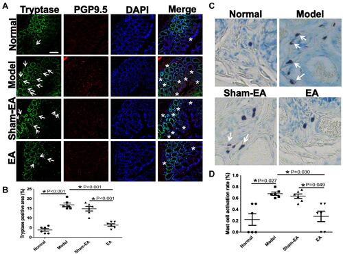 Figure 5 Expression and degranulation of mast cells in the distal colon in different groups of rats. (A) The expression of mast cells (tryptase+ cells) and the co-localization of mast cells (tryptase+ cells) and nerve endings (PGP9.5+ cells). Arrows indicate the tryptase+ cells. White stars show the connections between mast cells and nerves. Scale bar=50 μm. (B) Quantitative expressions of tryptase+ cells in different groups of rats. *P<0.05. (C) Toluidine blue staining of the distal colon with dark-violet-colored mast cells in a blue background (40×). Degranulated mast cells are noted with the presence of granules (indicated by white arrows). (D) Quantitative expressions of activated mast cells in different groups of rats. *P<0.05.