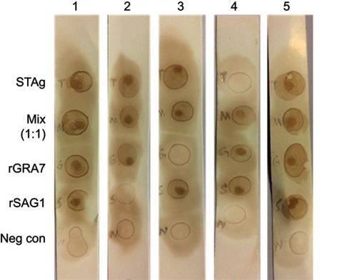 Figure 3 Reactivity patterns of in-house Dot-ELISA strip with various antigens for the detection of anti-T. gondii, antibodies. Five strips are shown in the figure as examples. All directions are from top to bottom. Strip 1, positive reaction of STAg, combination of rSAG1 and rGRA7 (1:1), rGRA7 and rSAG1 and negative reaction of negative control with patient sera. Strip 2, positive reaction of STAg, combination of rSAG1 and rGRA7 (1:1), rGRA7 and negative reaction of rSAG1 and negative control with patient sera. Strip 3, positive reaction of STAg, combination of rSAG1 and rGRA7 (1:1), rSAG1 and negative reaction of rGRA7and negative control with patient sera. Strip 4, positive reaction of combination of rSAG1 and rGRA7 (1:1), rSAG1, rGRA7 and negative reaction of STAg and negative control with patient sera. Strip 5, positive reaction of STAg, combination of the rSAG1 and rGRA7 (1:1), rGRA7 and rSAG1 and negative reaction of negative control with patient sera.