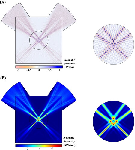 Figure 4. Distribution of pressure and acoustic intensity fields produced by focused ultrasound; The focus area in the center of the tumor has the highest pressure and acoustic intensity. The use of two transducers causes several focal points to be generated.