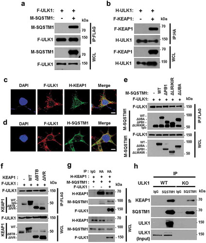 Figure 5. ULK1 interacts with SQSTM1 and KEAP1. Lysates from HEK293 cells transfected with vectors encoding FLAG-ULK1 (a) or HA-ULK1 (b) together with those expressing MYC-SQSTM1 (a) or FLAG-KEAP1 (b) were subjected to immunoprecipitation with antibodies against FLAG or HA, and the resulting precipitates (IPs) as well as whole cell lysates (WCLs) were subjected to immunoblot analysis using antibodies specific for the indicated proteins. Confocal microscopy analysis of co-localization of F-ULK1 and either H- KEAP1 (c) or H-SQSTM1 (d) Nuclei were stained with DAPI, and representative single optical sections and merge images are shown. Scale bars: 10 μm. Lysates from HEK293 cells transfected with deletion constructs of M-SQSTM1 (e) or KEAP1 (f) were subjected to immunoprecipitation with antibodies specific for FLAG, and the resulting IPs and WCLs were subjected to immunoblot analysis using antibodies specific for the indicated proteins. (g) Lysates from HEK293 cells transfected with F-ULK1, H-KEAP1, and M-SQSTM1 were subjected to immunoprecipitation with antibodies to HA, and the resulting IPs and WCLs were subjected to immunoblot analysis using antibodies specific for the indicated proteins. (h) Lysates from Ulk1 WT or ulk1 KO MEF cells were subjected to immunoprecipitation with antibodies to SQSTM1, and the resulting IPs and WCLs were subjected to immunoblot analysis using antibodies specific for the indicated proteins.