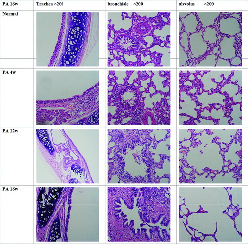 Figure 1.  Pathological examination of the lung.