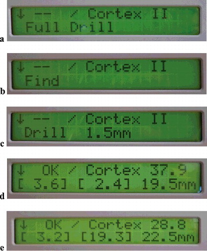 Figure 2. Software realization of the working modes: Full drill mode setting (a); find far cortex (Cortex II) mode setting (b); Fixed depth II mode setting (c); information displayed after Full drill end (d); information displayed after identifying the far cortex (e).